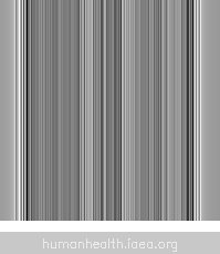 A grey and white striped background